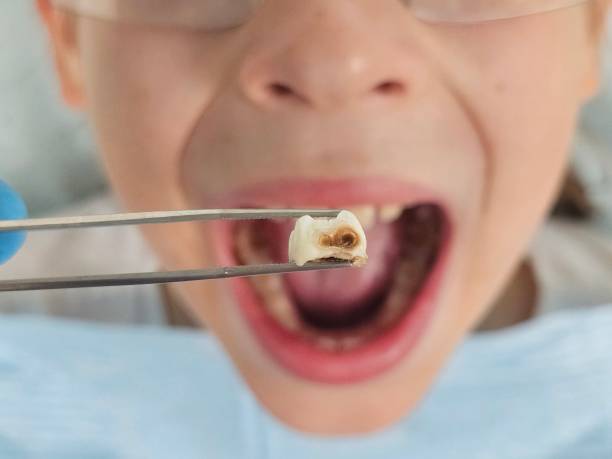 Best Emergency Orthodontic Repairs in Bonham, TX
